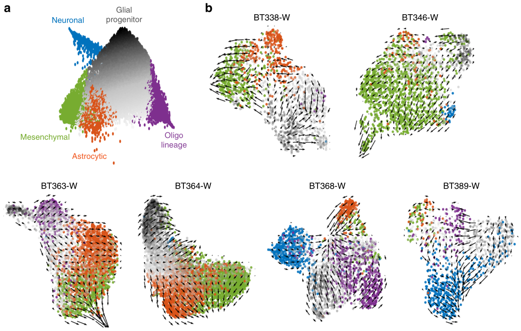 膠質母細胞瘤RNA速度分析