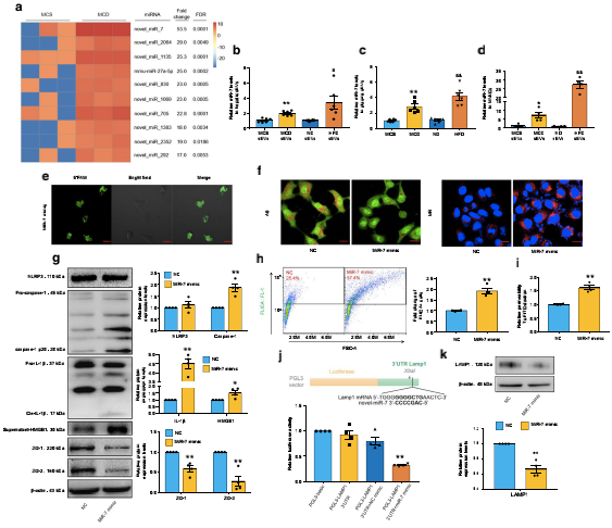 NAFLD肝源性外泌體通過(guò)激活組織蛋白酶B/NLRP3免疫激酶體軸誘導(dǎo)微血管內(nèi)皮細(xì)胞高通透性