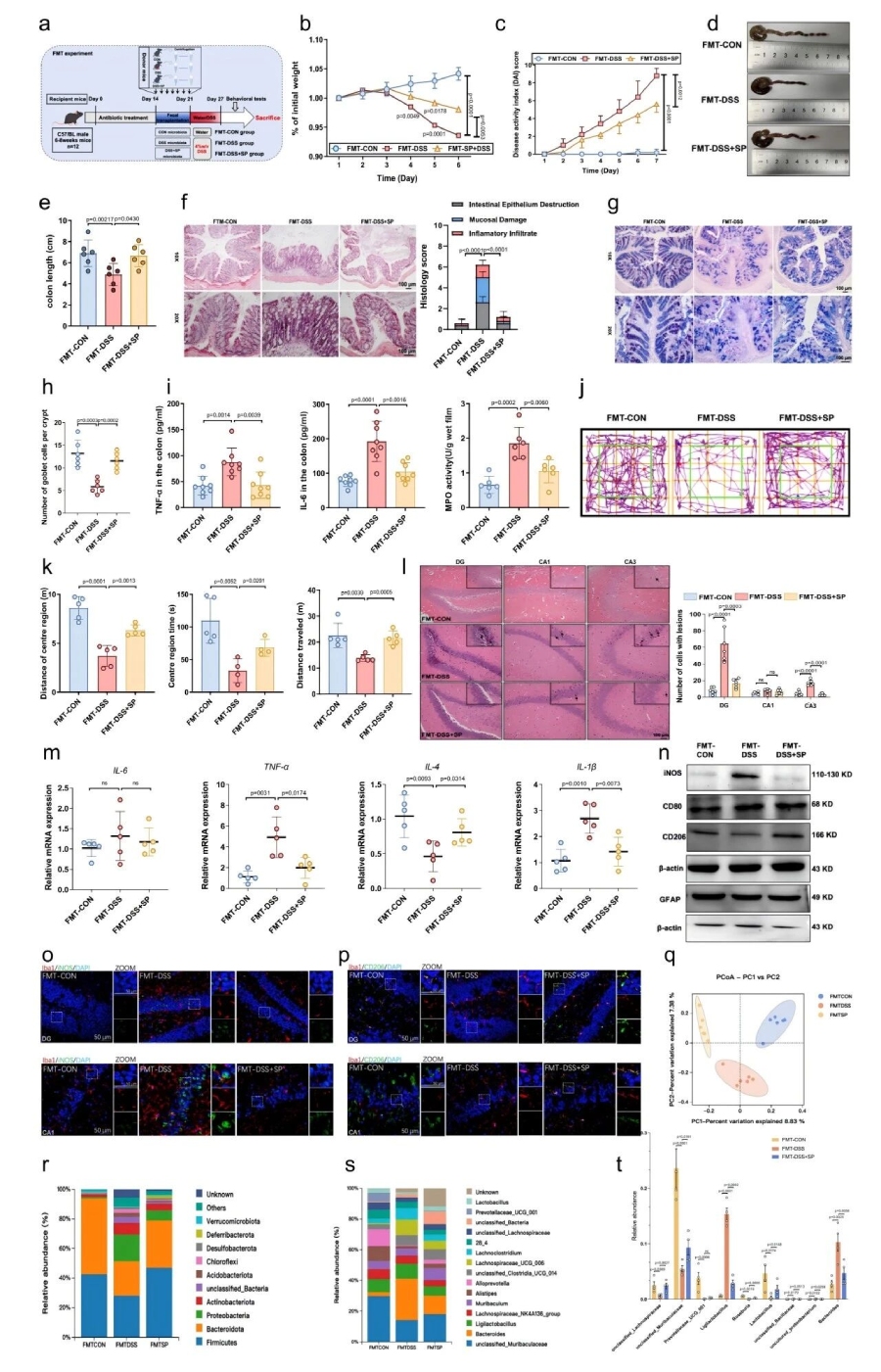 圖5 FMT實驗表明SP通過調節(jié)腸道菌群減輕了DSS誘導的結腸炎和焦慮樣行為
